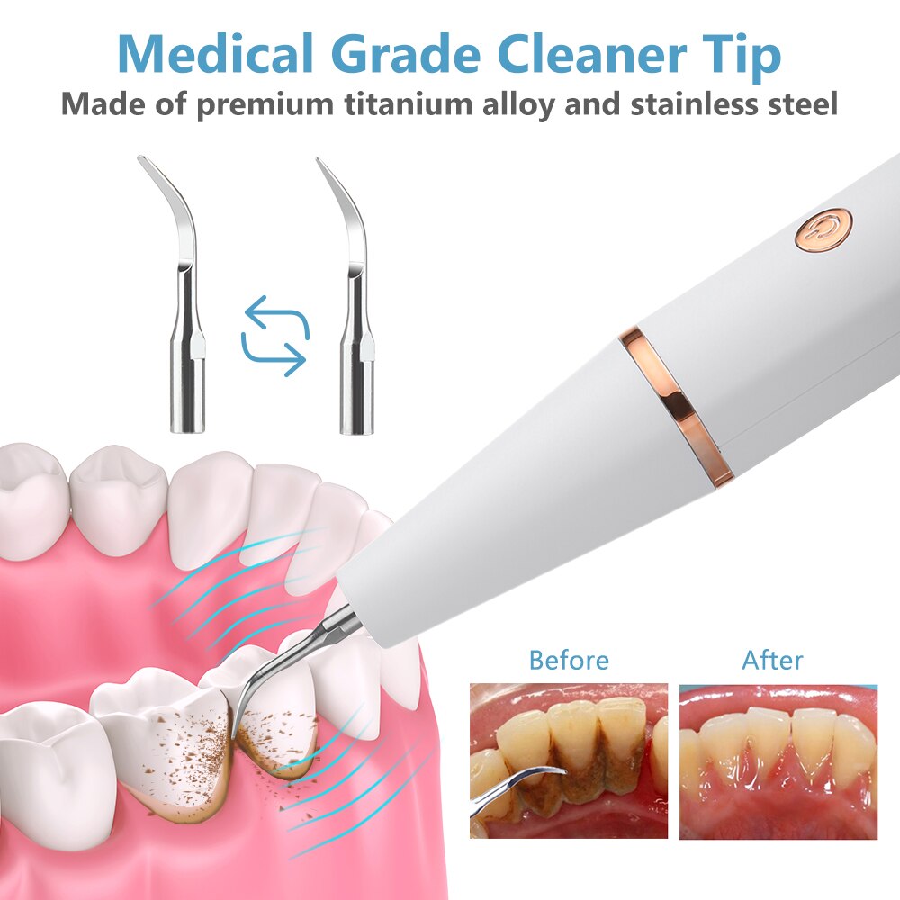 HYDRO JET Water Flosser, 350ML 5 Nozzles Mouth Washing Machine | ULTRASONIC Electric Dental Scaler Oral Hygiene Kit Teeth Calculus Plaque Remover for Teeth
